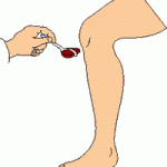 knee jerk